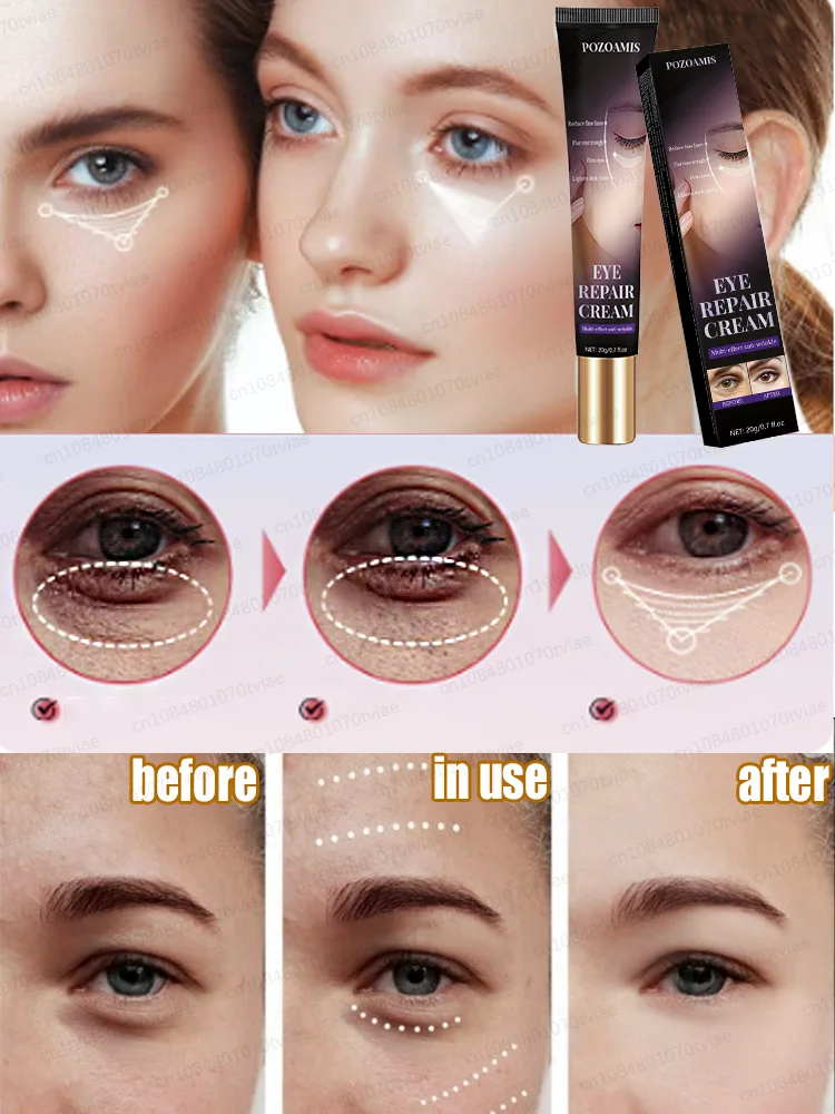 Crème contour des yeux pour éliminer rapidement les poches et les cernes