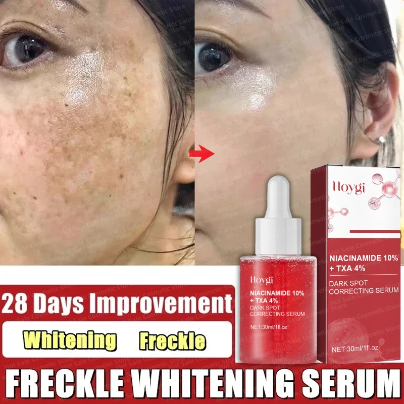 

Niacinamide Whitening Freckles Serum Dark Correcting Serum Removal Melasma Dark Spots Lighten Melanin Pigmentation Brightening