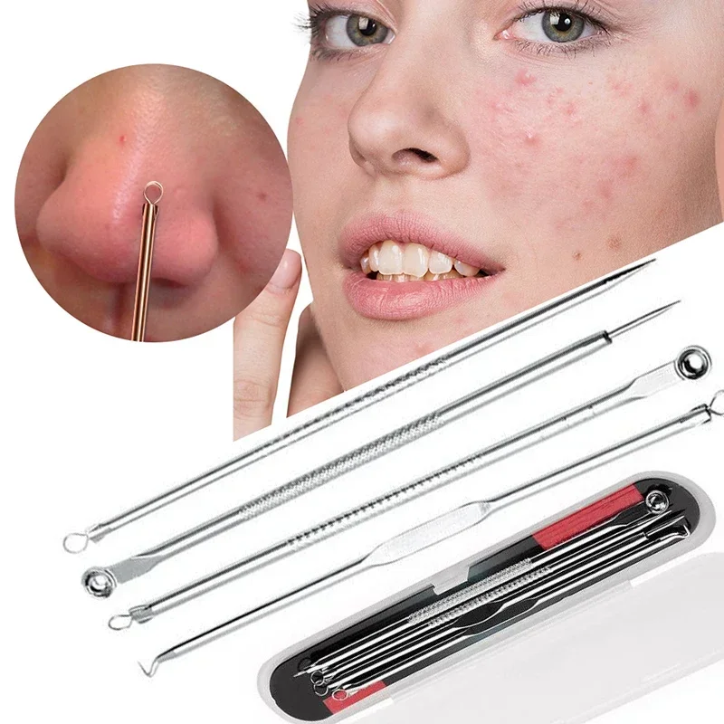 4pcs/set Blackhead Comedone Acne Pimple Blackhead Remover Tool Spoon for Face Skin Care Tool Needles Facial Pore Cleaner