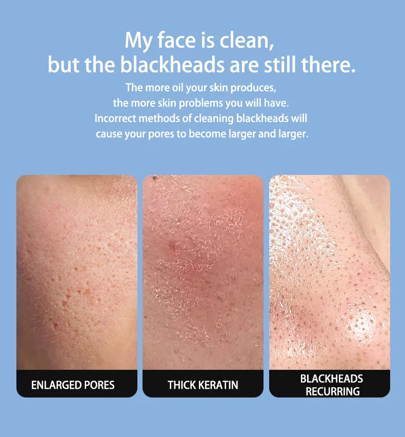 المكتبة الذكية أداة التجميل المنزلية السوداء مجرفة بالموجات فوق الصوتية تهتز سكين كهربائي لإزالة الرؤوس السوداء تطبيق العناية الشخصية #2