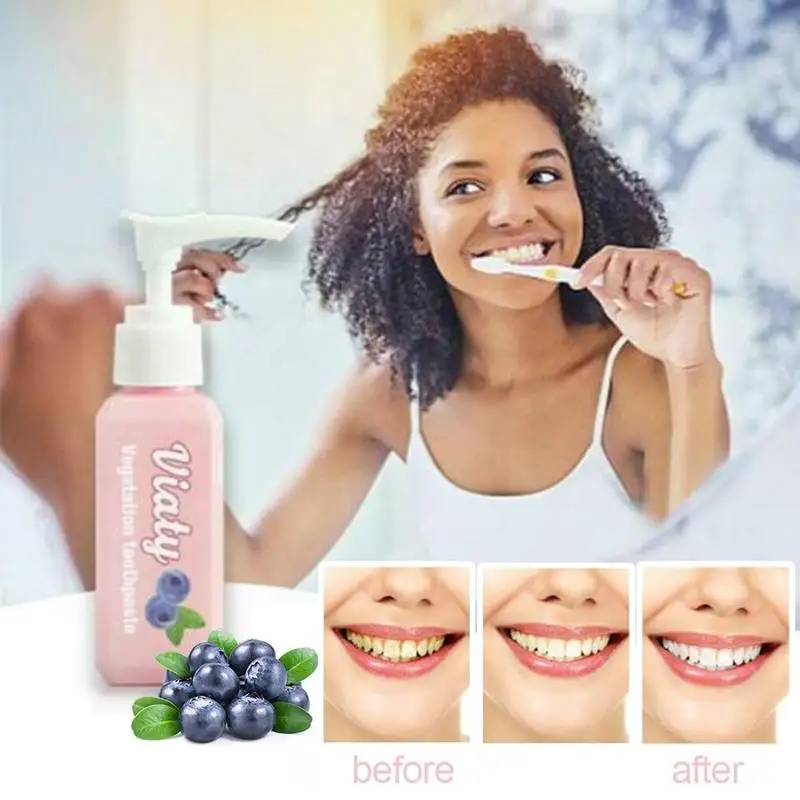 Sdotter-Vivid Vegetação Creme dental, Remoção de fumaça mancha, Reduzir dente, Sujeira, Whitening Creme dental, Luta Sangramento Gums, Toothpast, Novo