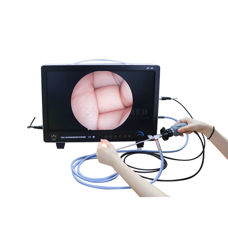 SY-PS050 integrated Full HD 22 inch laparascope endoscope system with light source