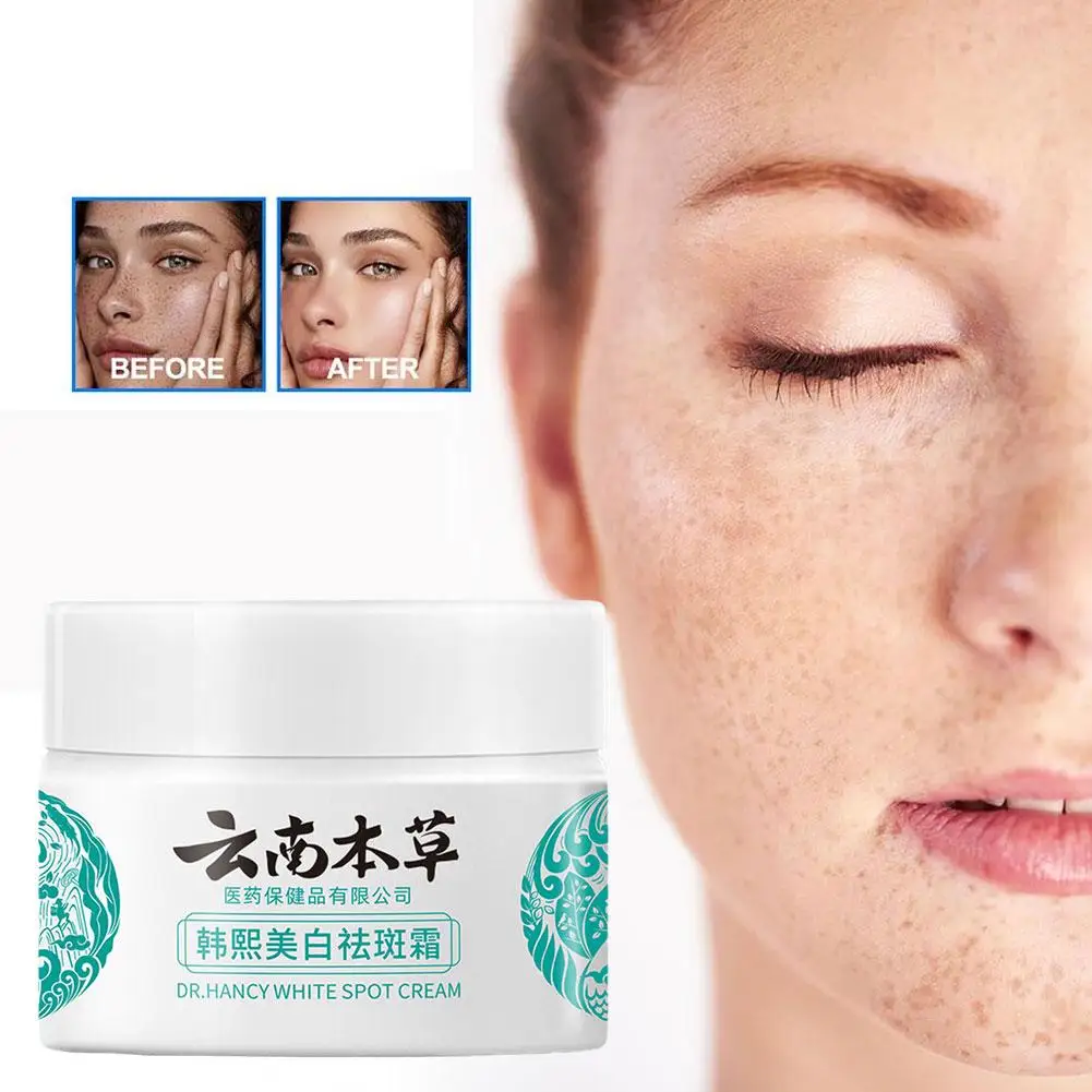 20g Powerful Whitening Freckle Cream Remove Acne Spots Dark Spots Face Moisturizing Face Skin Care Beauty