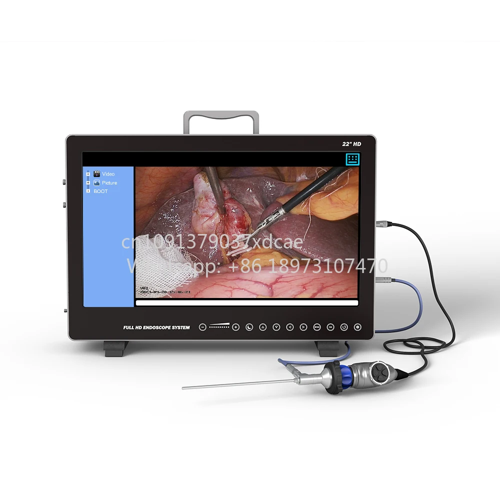 2026 New 80W Optical Nasal Endoscope HD Camera Video Processor Electric Power USB