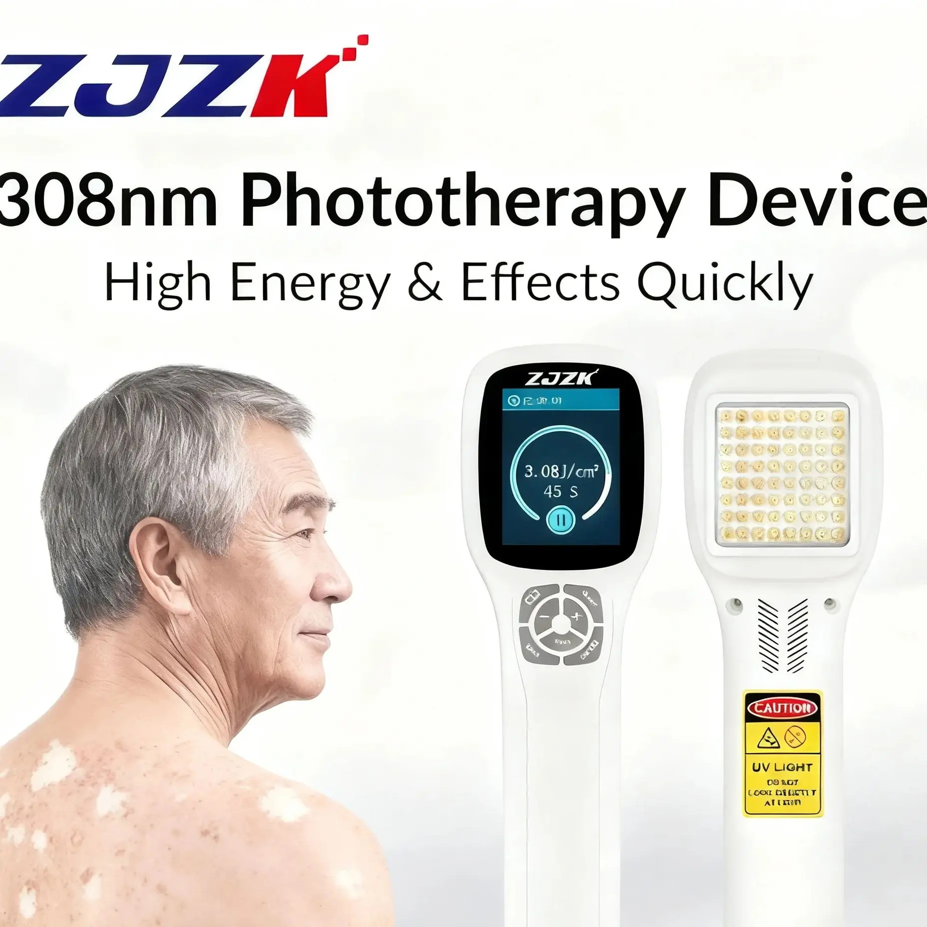 

Uvb 308nm Lamp Phototherapy Equipment 49 Diodes Portable Ultraviolet Light Therapy Machine Psoriasis Vitiligo Eczema Treatment