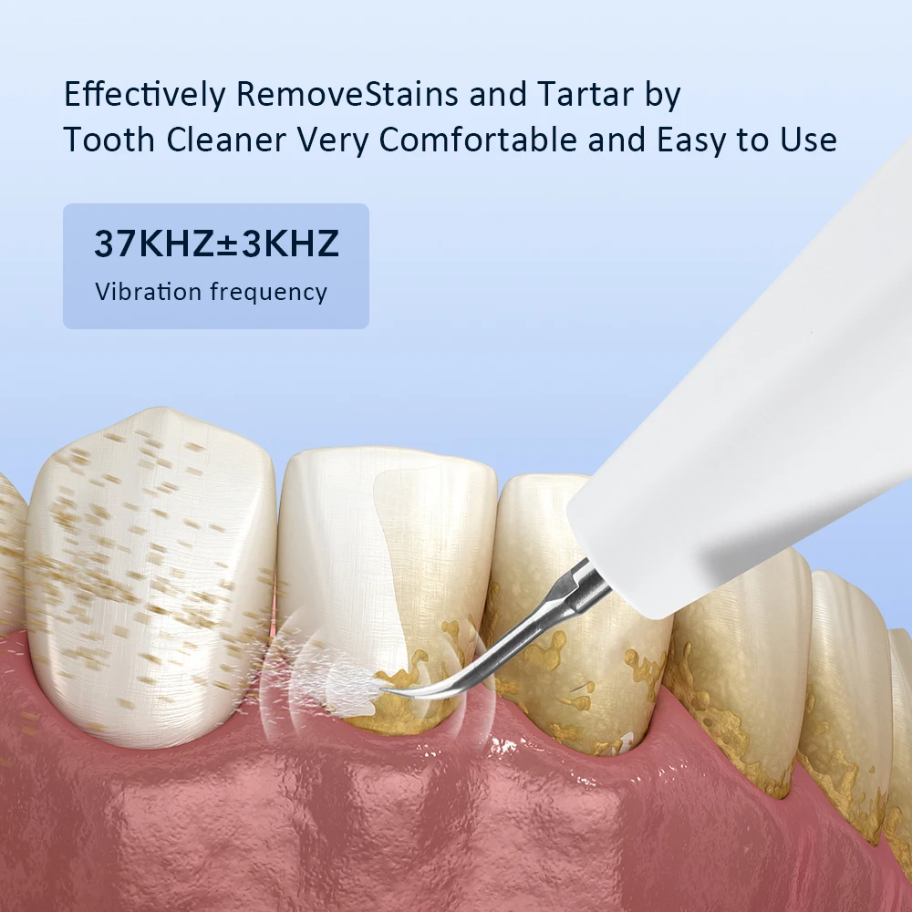 Limpiador de Sarro Dental Ultrasónico Eléctrico, Herramienta de Cuidado Bucal para Blanquear los Dientes, Eliminar Manchas y Placa