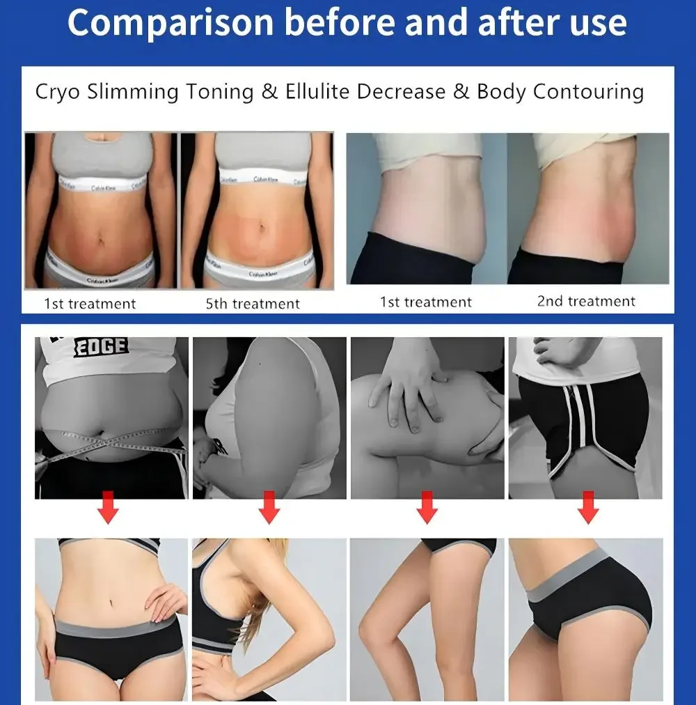 Body Shaping Machine Roller Massager Slimming 3 in 1 Beauty Device Cooling Therapy Equipment Skin Tightening Cellulite Care