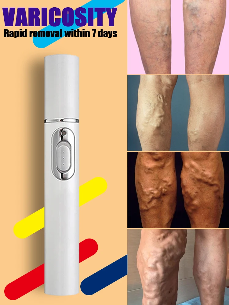 Spider leg laser vascular dredging pen