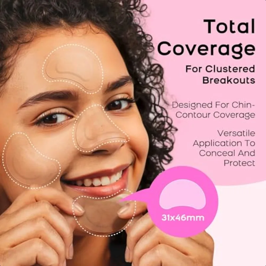 ハイドロコロイド顎ニキビパッチXL特大ニキビパッチ（顔、顎、体のニキビ用）ティーツリー、カレンデュラオイル配合（ニキビ跡用）