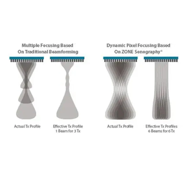 Mindray Vetus E7 Color Portable Ultrasonic Diagnostic Veterinary Ultrasound Examination Equipment