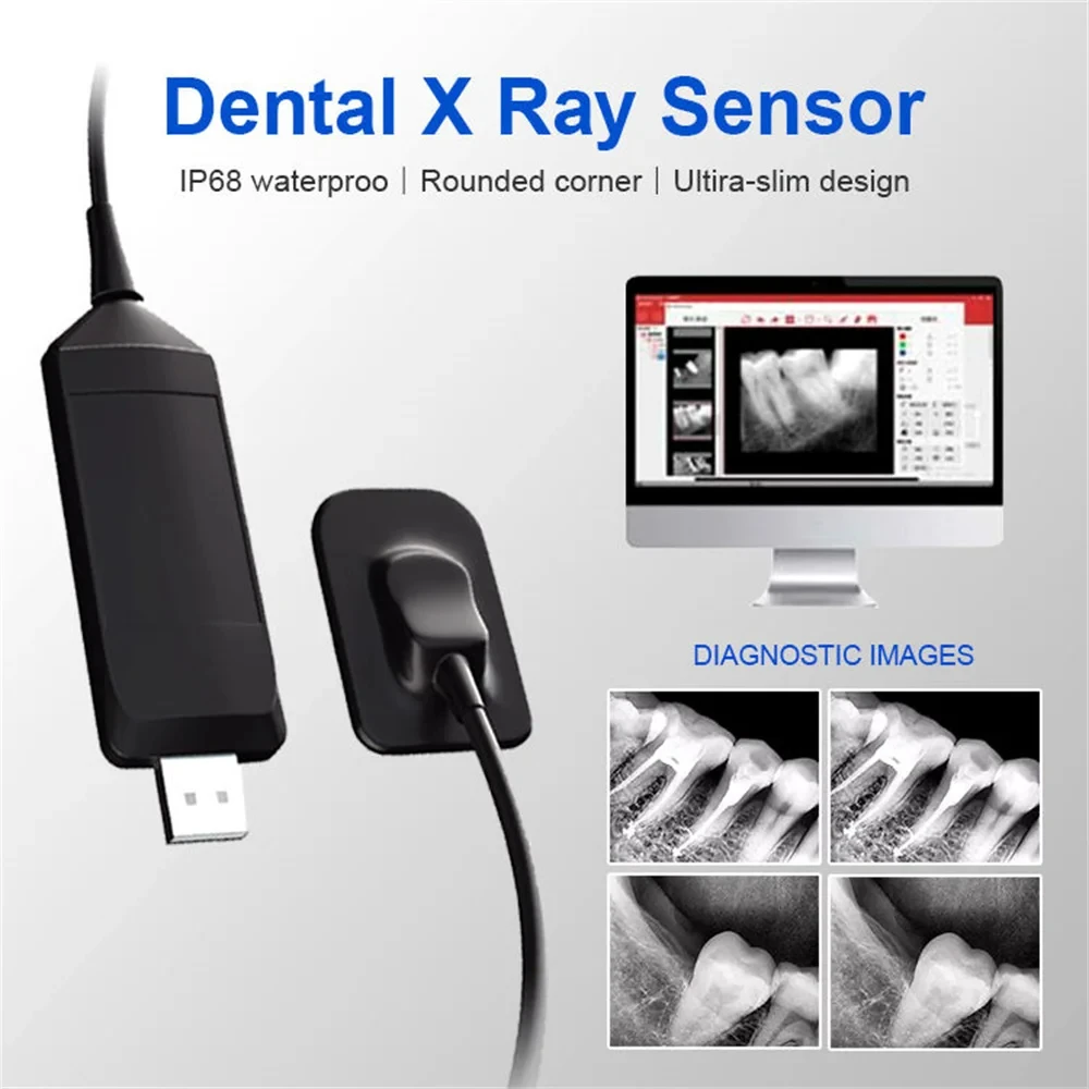 Intraoral Digital Imaging System R1/R2 Dental Sensor USB Handheld Digital Intraoral Sensors for Dentist Clinic