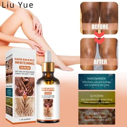 Skin Beauty Essence Lighten Skin Tone Removal Elbows Knee Melanin Dark Knuckle Reduce Dullness Moisturizing Brightening Serum