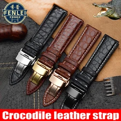 For Longines Omega Rossini Citizen Tissot  Watch strap Crocodile leather Men Women butterfly Clasp watchband 14 16 18mm 19 20mm