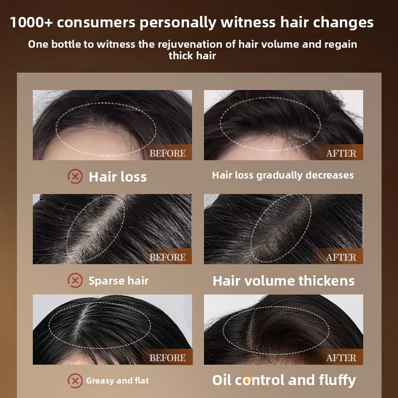 Botanical Shampoo Plant Extracts Nourish Hair Anti-Hair Loss & Strengthening Soft Silky Amino Acids Soft Mild Non-Irritating