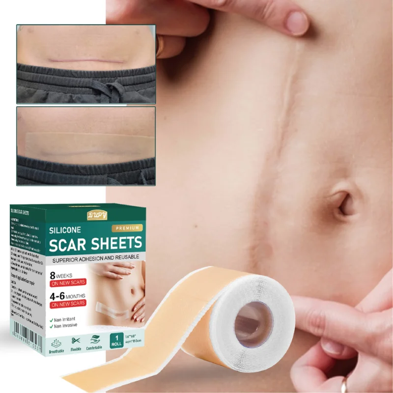 

Self Adhesive Silicone Scar Sheets Breathable Waterproof Medical Grade Scar Cover Surgery Skin Repair Section Ear Healing Patch