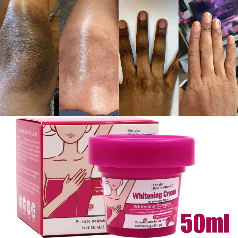 

Whitening Cream For Dark Skin Armpit Thigh Inner Joint Lightening Intimate Area Underarm Body Care Private Parts Brighten Lotion