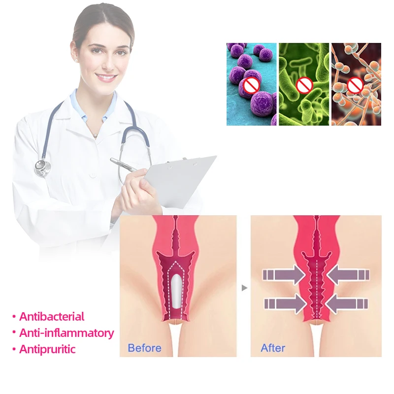 Herbal Vaginal Tightening Supository Melts Ovule Womb Vaginale Detox Gynaecology Vagina Tighten Medical Vaginitis Treatment