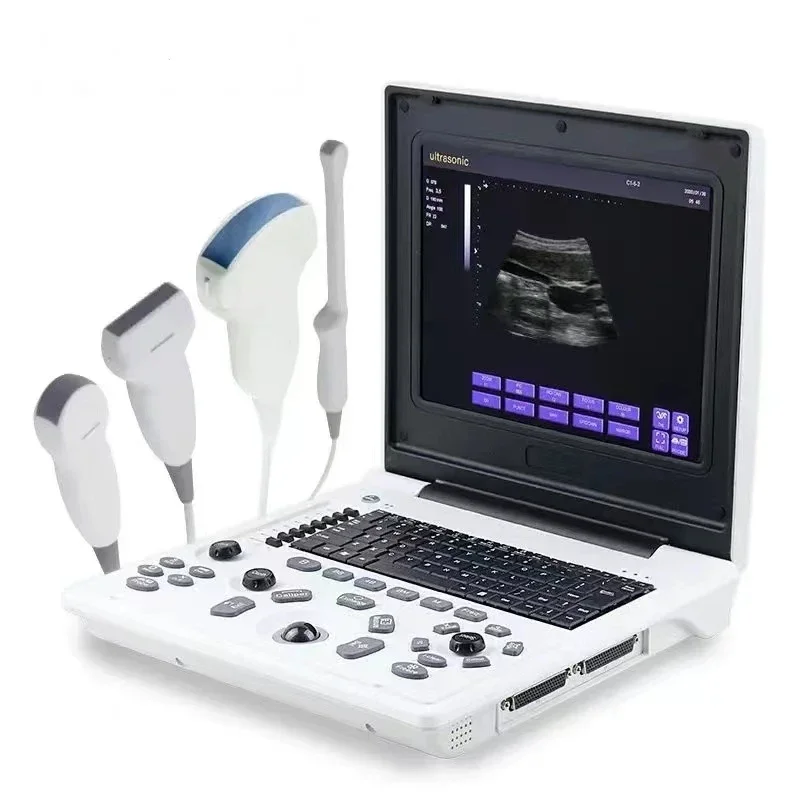 New Upgrade Human Use Diagnostic Echo Notebook Digital B Ultrasound Scanner Machine