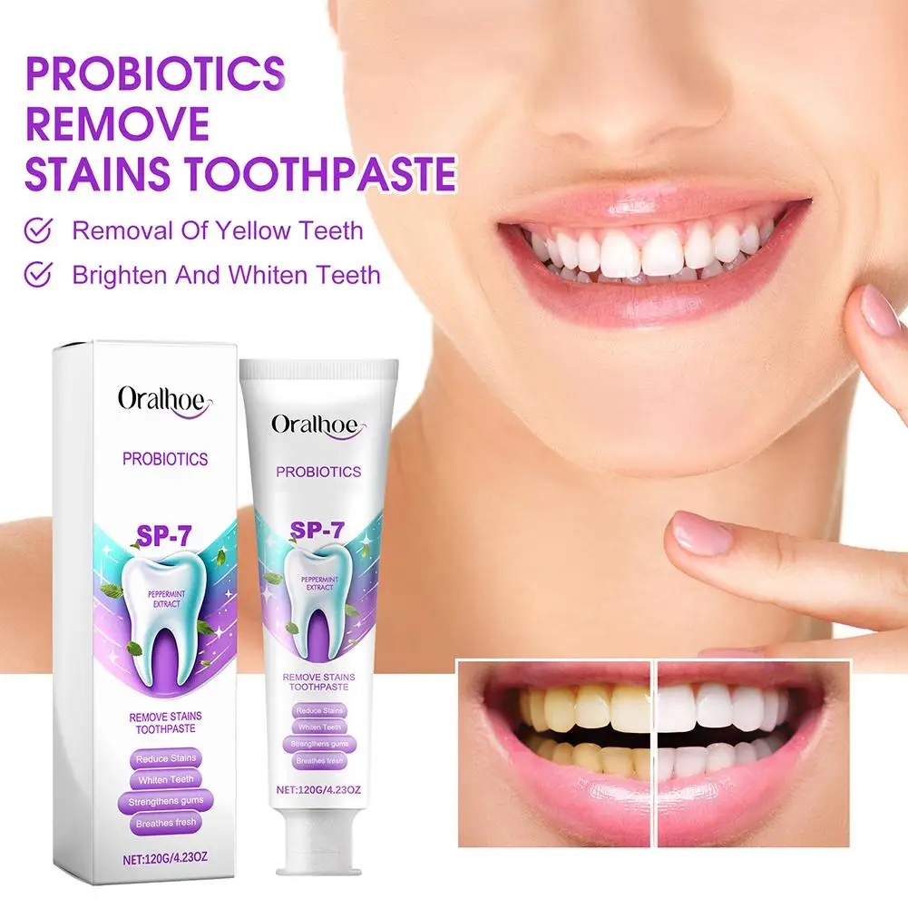 SP 7 dentifricio schiarente probiotico igiene orale del dentifricio rinfrescante con alito sbiancante e probiotici 120g N0O3