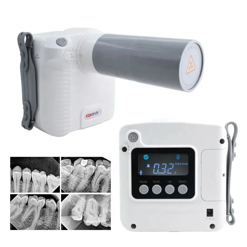 Intraoral Digital X…