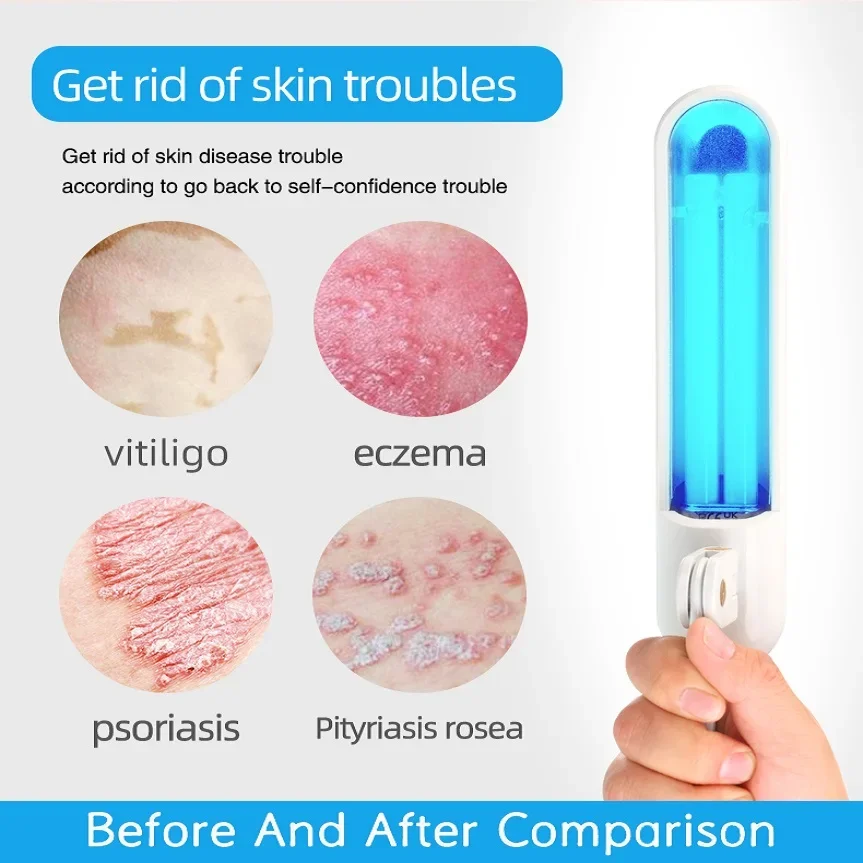 Thumbnail 2 - #31 Compare Light Therapy Lamps Before You Buy