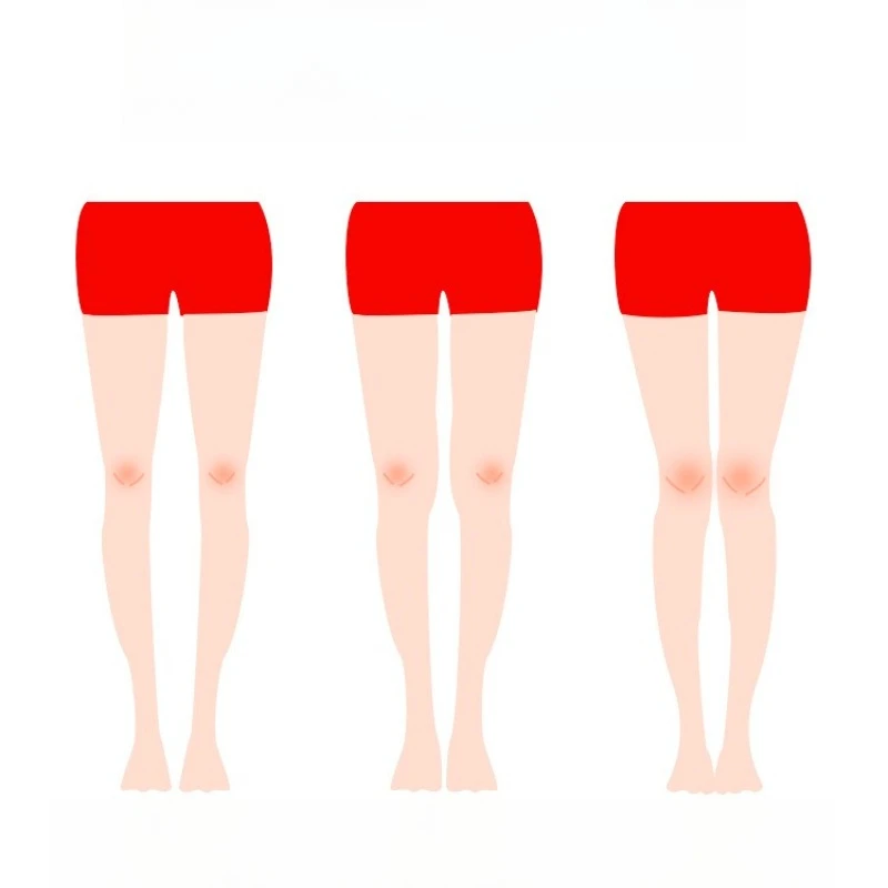 Children Adult Inner Eight Loops Leg Orthotics X-Leg O-Leg Straight Leg Leggings Leggings Strap Leg Correction Strap