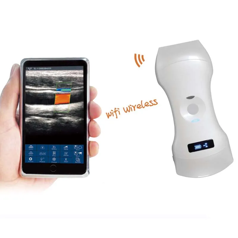 cheap price wireless medical wholesale high resolution display handheld ultrasound scanner portable ultrasound device