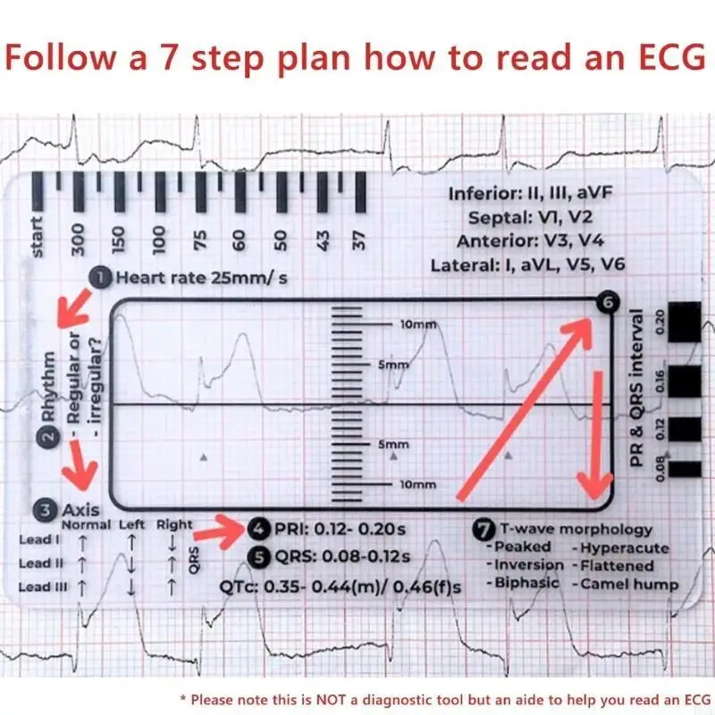 P82E Electrocardiogram 7 Step Ruler Card For Accurate Interpretation & Quick Analysis