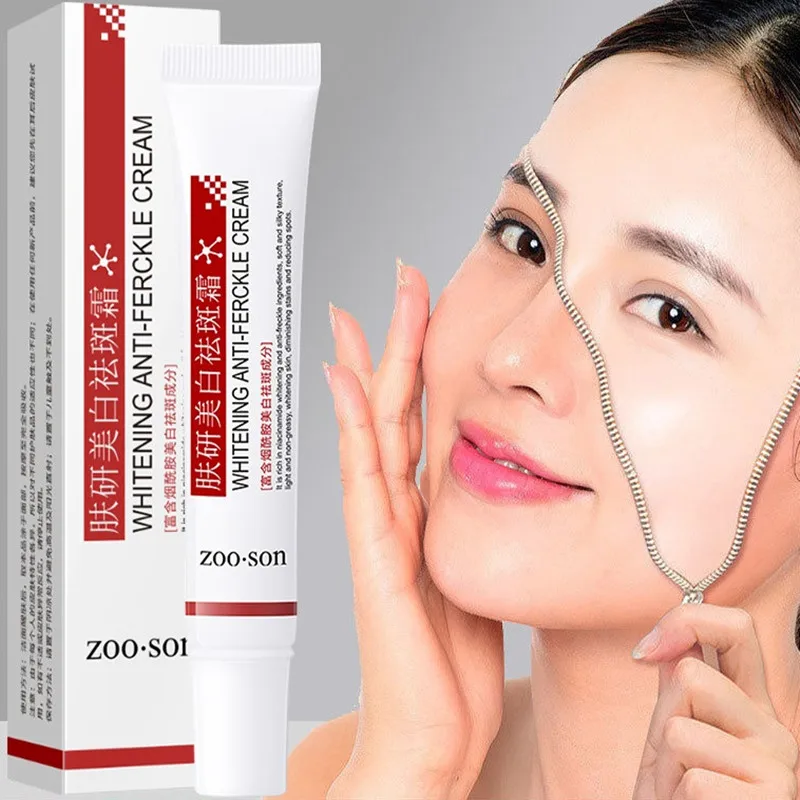 كريم النمش الفعال يضيء الوجه بسرعة إزالة الكلف البقع الداكنة تتلاشى الميلانين تبييض المضادة للتصبغ تحسين بلادة #1