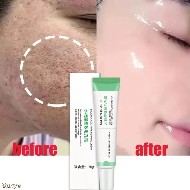 

Quick Pore Shrinking Cream Removal Large Pores Blackhead Moisturizing Brightening Face Creams Smooth Lighten Skin Care Product