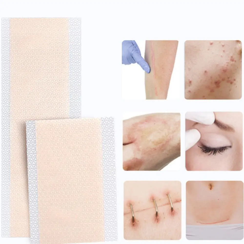 Waterproof Flaw Hide Stickers Invisible Ultra-thin Black Spot Full Cover Natural Look Silicon Gel Tattoo Cover Up Sticker Skin