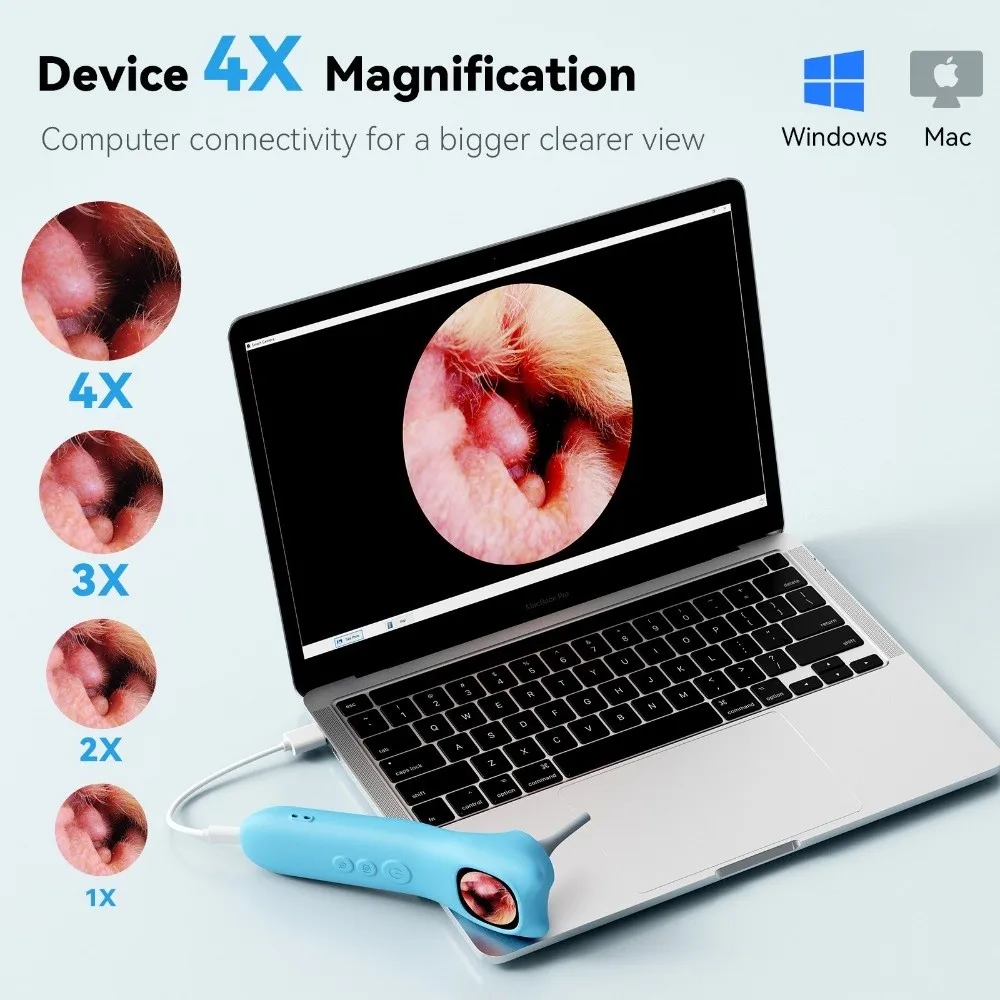 

1080P HD Smart Detector 5-in-1 Function 1.21 Inch IPS Screen Ear Camera Twelve Replacement Heads Rechargeable Digital Ear Camera