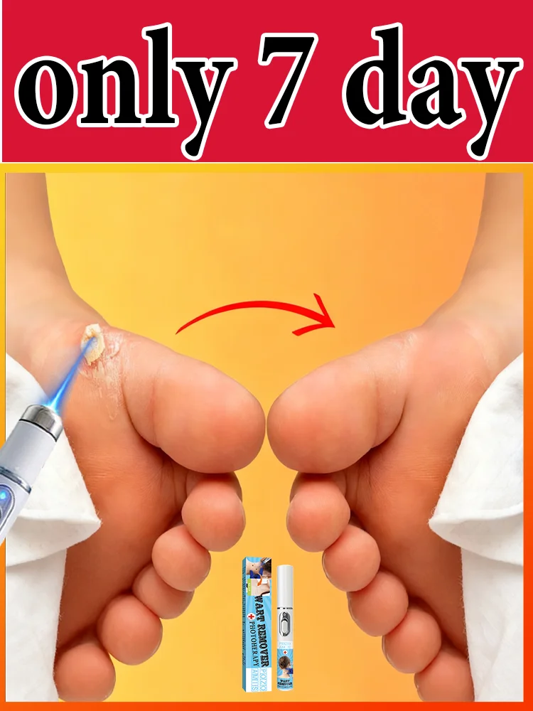 

ʙʟᴜᴇ ʟɪɢʜᴛ ᴘᴇɴ sᴏʟᴠᴇ ᴡᴀʀᴛs, ʜᴏᴛ sᴀʟᴇ ᴡᴀʀᴛ ᴄᴀʀᴇ ᴛᴏᴏʟs