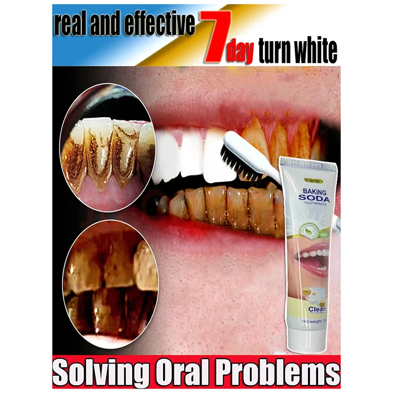 Remover Tartar Toothpaste Keeps Mouth Fresh Removal Bad Breath Odor Whitening Teeth Preventing Periodontitis Products