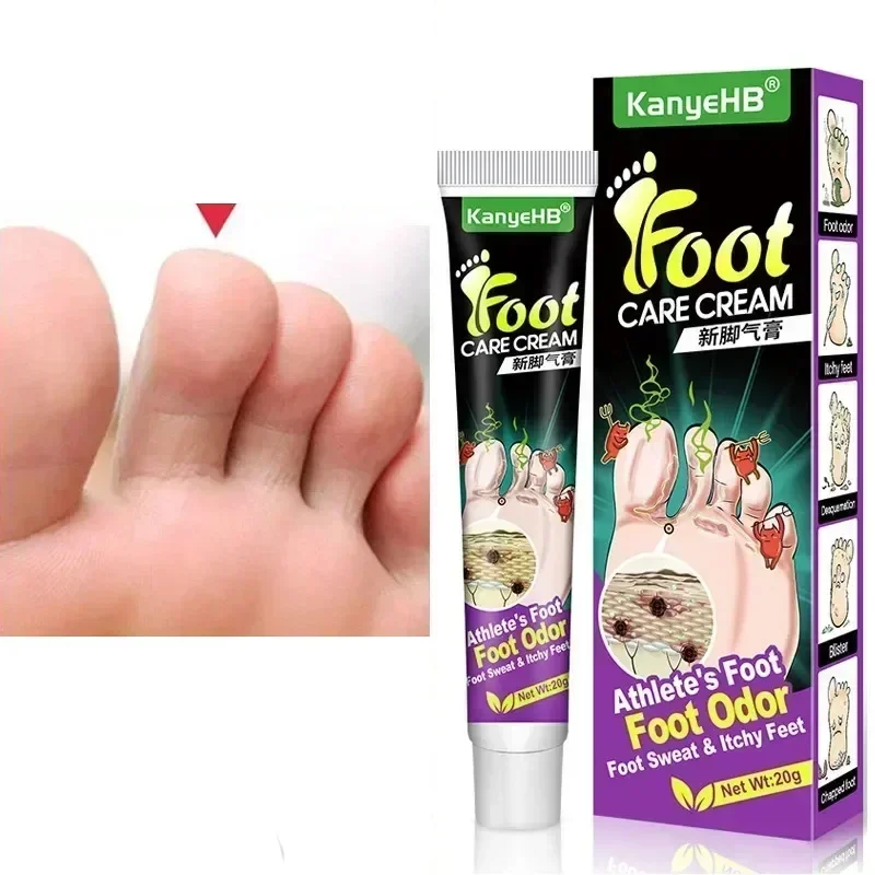 Wellness Foot cream rimuovi odore Beriberi piedi sudati piede d'atleta peds deodorante cura dei piedi