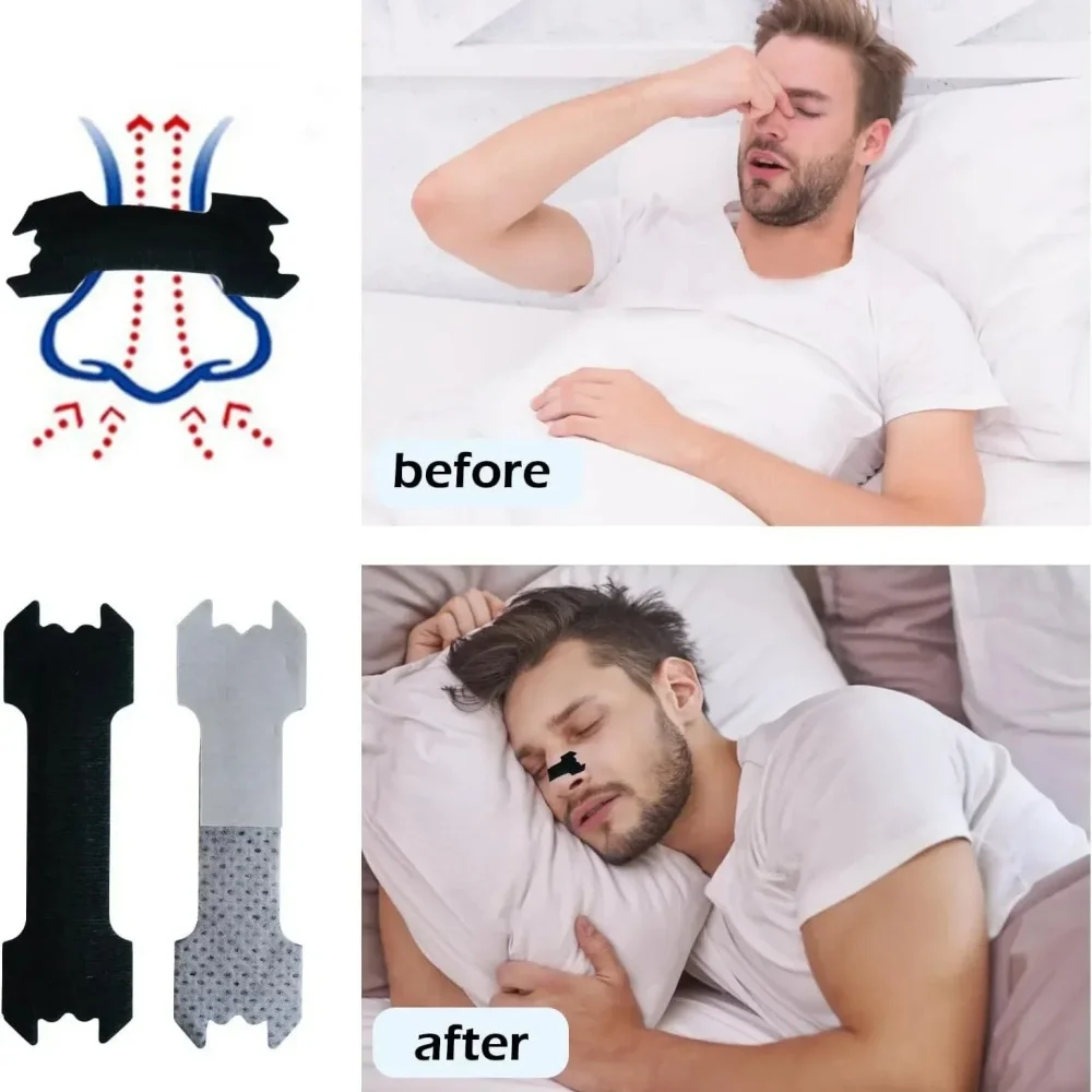 30PCS Anti Snoring Nose Patch Breathable Comfortable Design Improve Sleeping Health Product Stop Snoring Easier Sleep Aid Device