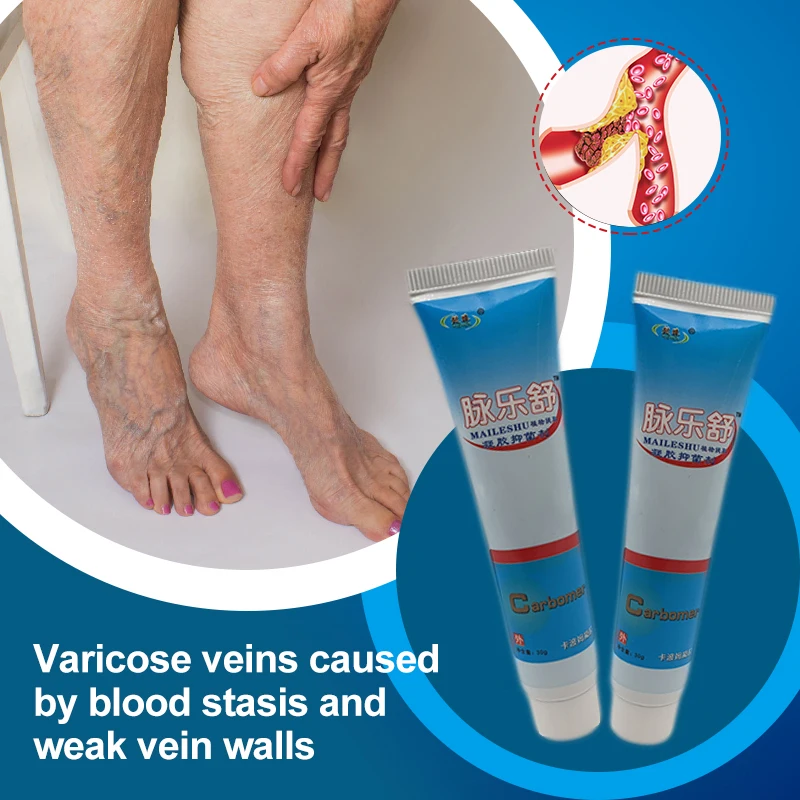 10pcs/lot ZB Varicose Veins Cream 30g Hot Sale Vasculitis Phlebitis Spider Cream Varicosity Angiitis Removal Medical Plaster