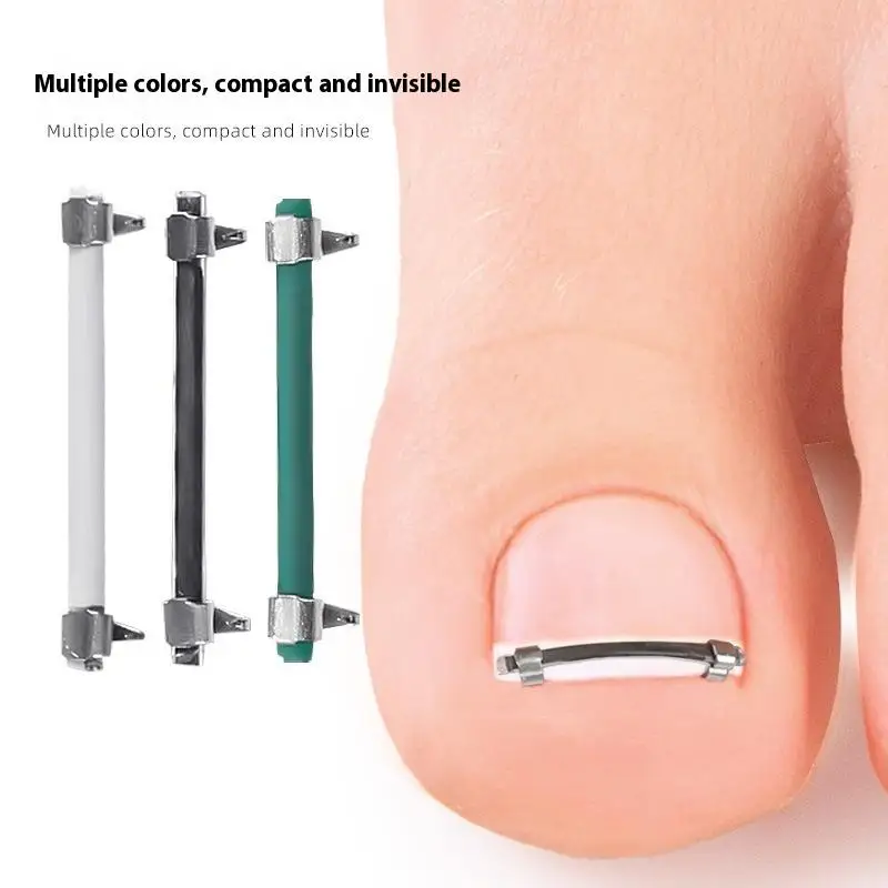 Ingrown Toenail Pedicure Tool Embed Toe Nail Care Straightening Correction Clip Curved Clamp Toenails Correction Tool For Toes