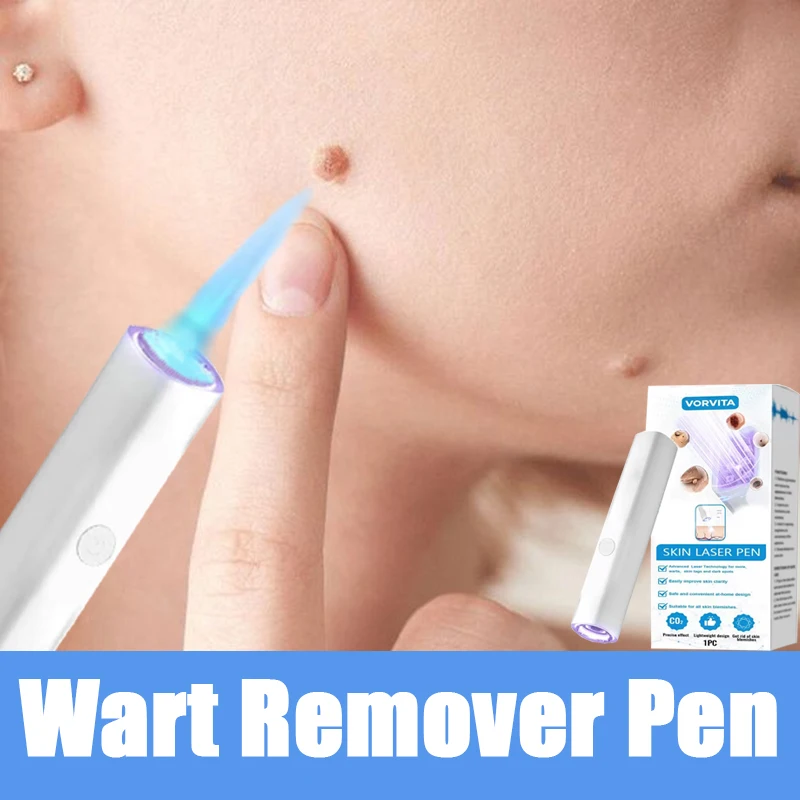 

Ручка с синим светом решает проблемы с кожей, горячие инструменты для ухода за бородавками