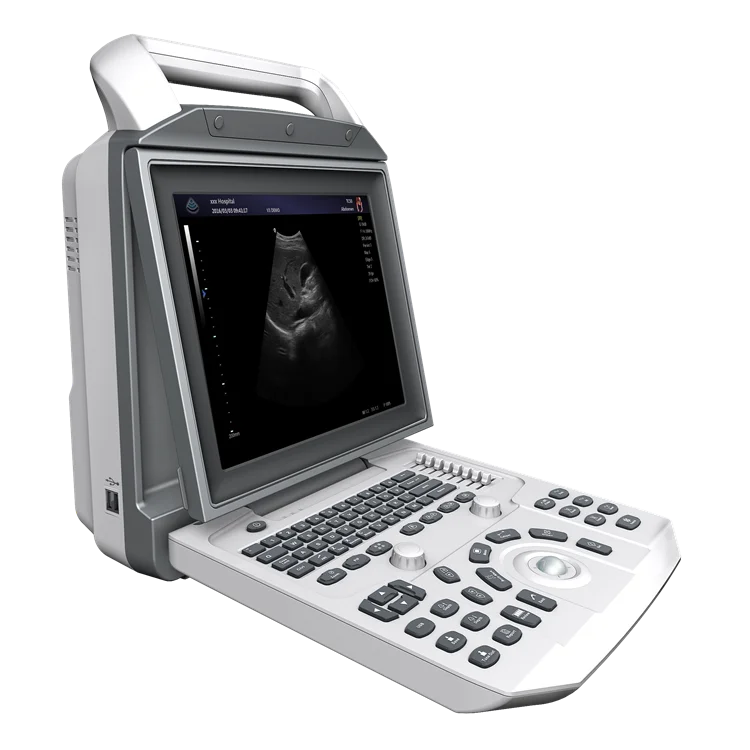 

Portable All Digital B/W Ultrasounid Machine Medical Ultrasound Scanner Equipment for Human/Veterinary