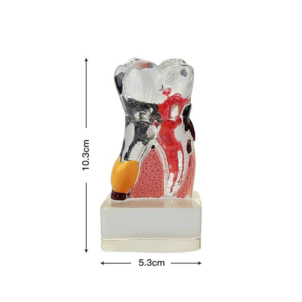 Teeth Anatomy Dental Model Teaching Study Transparent Molar Periodontal Disease Model Dentistry Dentist Demonstration Model New