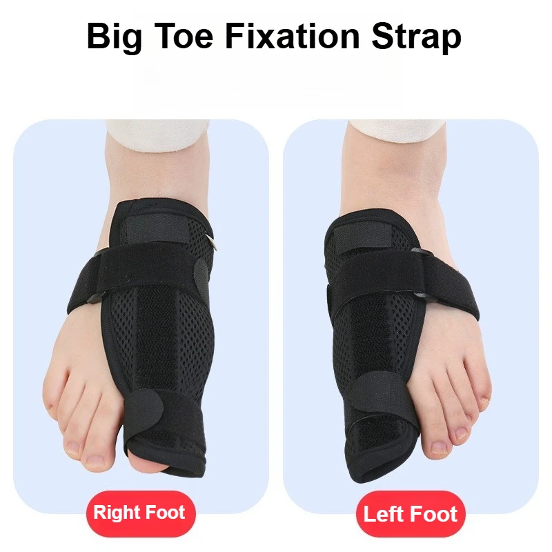 Hallux Valgus Corrector Big Toe Straightener Bunion Splint Overlapping Separator Orthopedic Day Night Adjustable Strap Pro