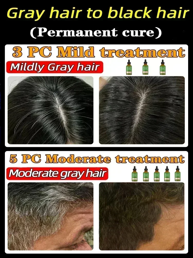 Anti-Grey Hair Essence Serum, Restaurar, Cor Natural, Restaurar, Saudável, Branco para Preto