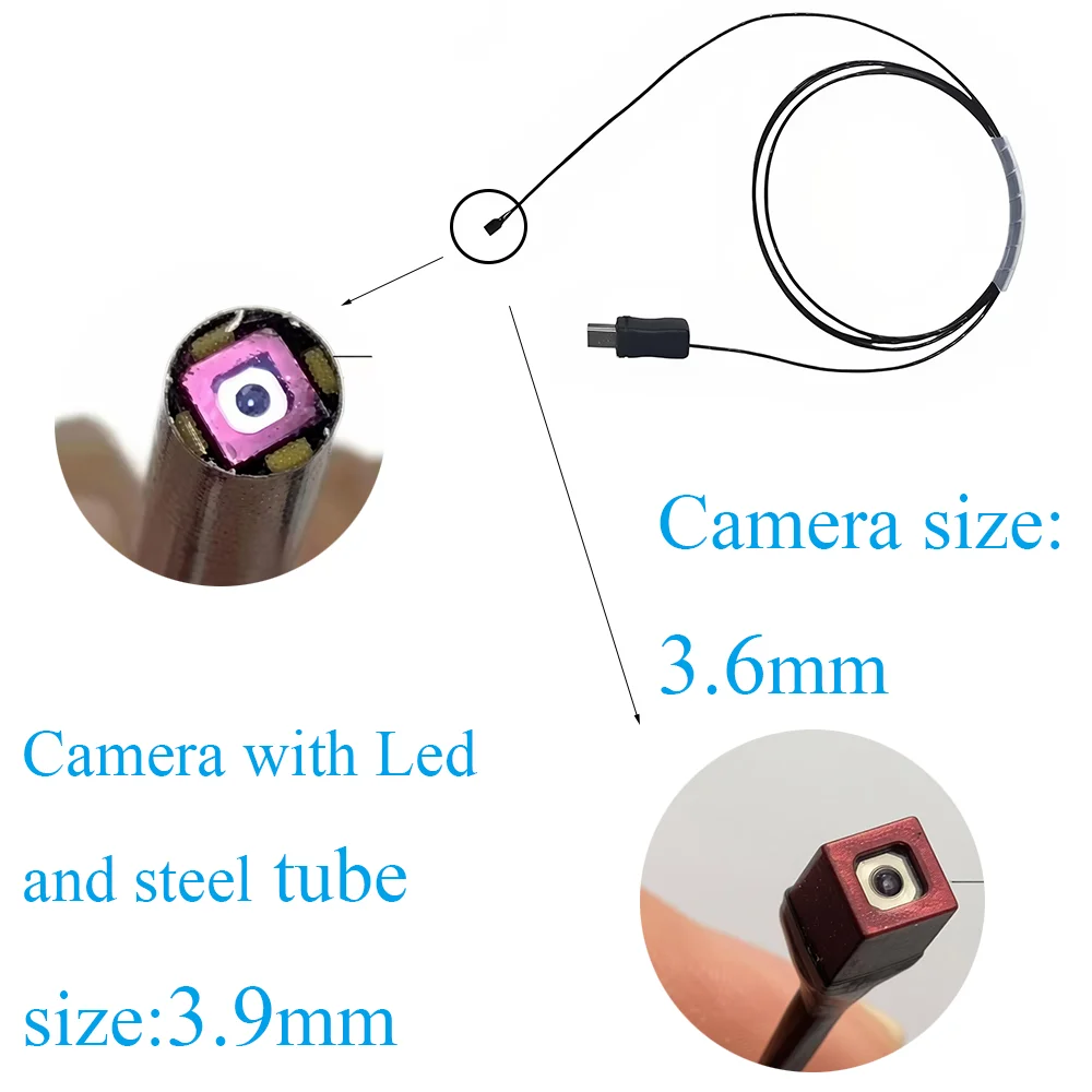 Customized Medical  Camera Module, 1500*1500 High Resolution, Mini USB Interface