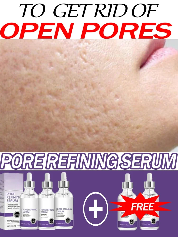 Suero de rejuvenecimiento de poros para la piel, rejuvenecimiento de la piel, potente encogimiento de poros para estirar y eliminar los poros grandes en la cara