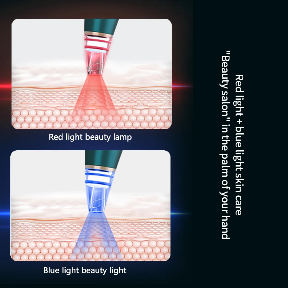 Biblioteca intelligente Pulizia del viso Punti neri Aspirazione Esfoliante Bellezza Acne Brufolo Rimozione Strumento Cura Professionale Punti neri Re