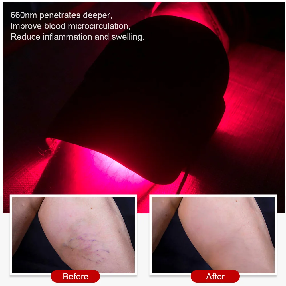 Suyzeko Portable Infrared LED Light Therapy Machine 660nm 850nm PDT Anti-Inflammation Body Face Belt Pad Pain Relief Feet Care