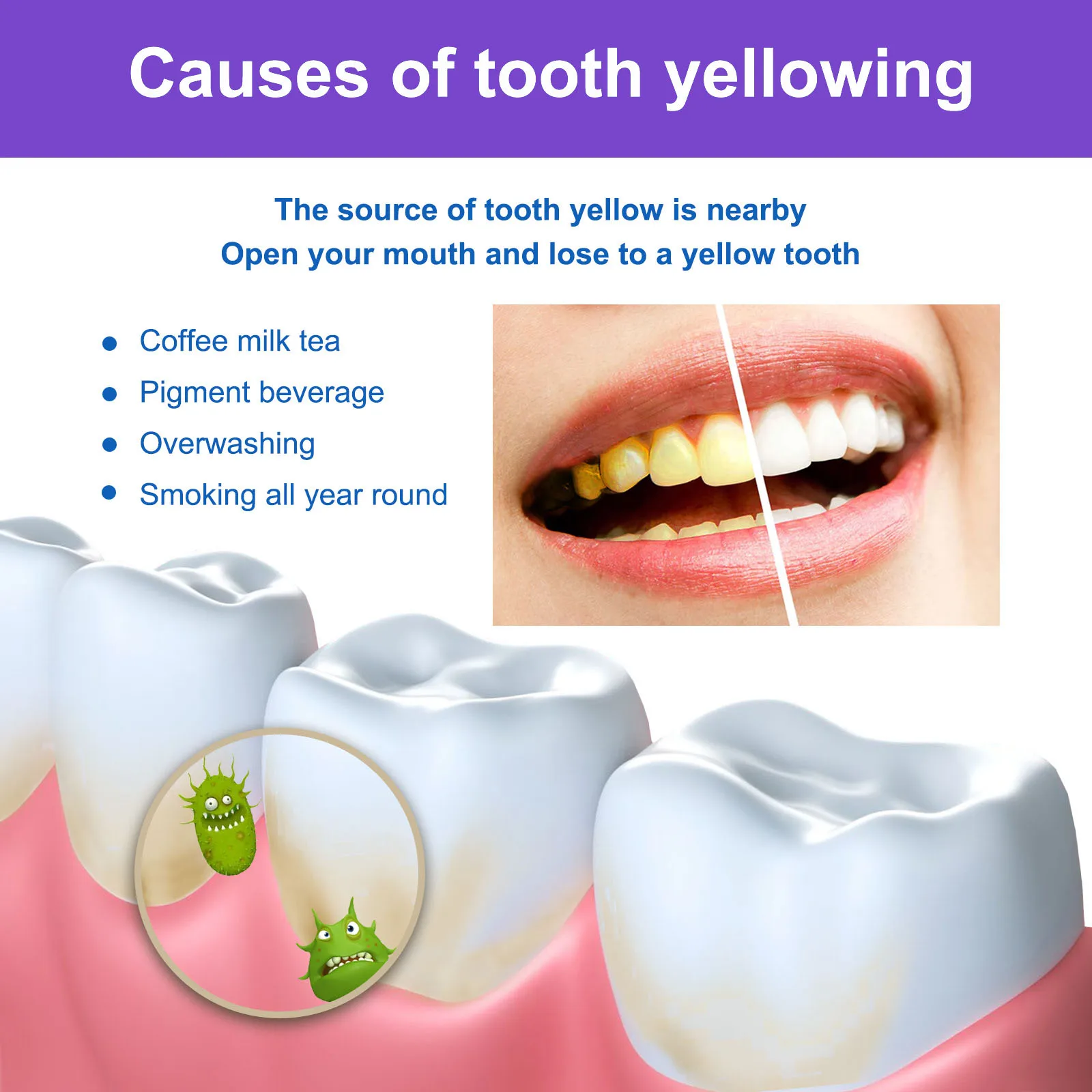 Purple Teeth Whitening Strips Brighten Tooth Remove Plaque Stain Cleaning Oral Hygiene Reduce Sensitivity Bleaching Dental Tools