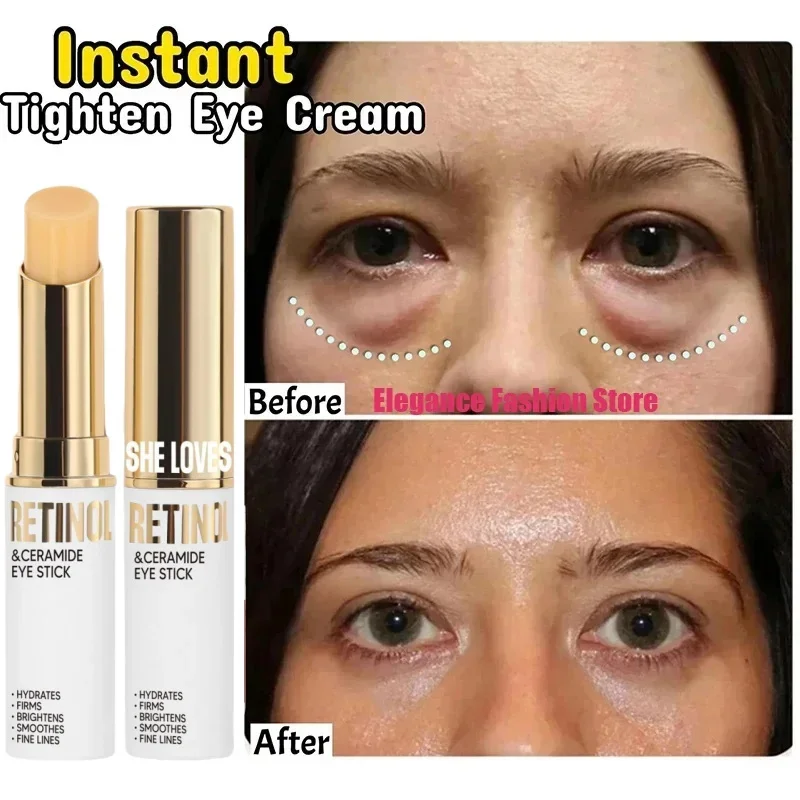 

Instant Eye Bag Remove Eye Cream Anti Fat Particles Dark Circles Puffiness Fade Fine Lines Lift Brighten Korean Beauty Eye Care