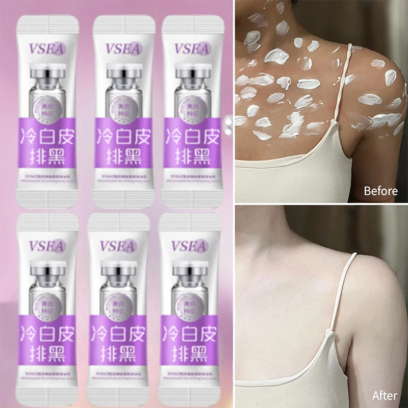 

Niacinamide Skin Whitening Cream Pigmentation Removal Cream Body Care Lotion Lightening Brighten Cream For The Body Moisturizer